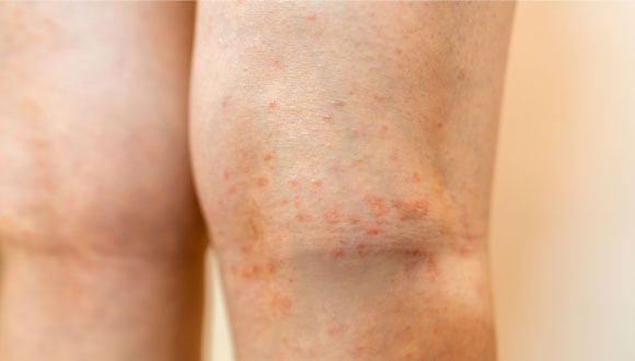 適切な治療目標設定、新しい治療の導入